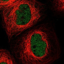 MASTL Antibody, Novus Biologicals 0.1mL; Unlabeled:Antibodies, Polyclonal